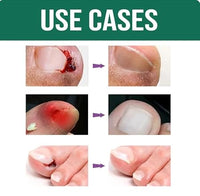 Anti-Fungal Nail Repair Oil