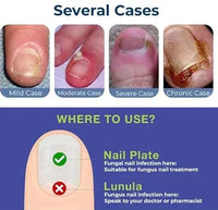 Anti-Fungal Nail Repair Oil
