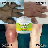 Bee Venom Pain Relief Cream (Pack of 3)