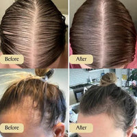 Vegan Hair Growth Oil (Pack of 2)
