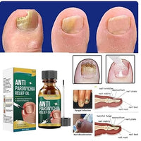 Anti-Fungal Nail Repair Oil