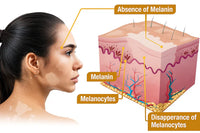 Bee Venom Skin Corrector Cream